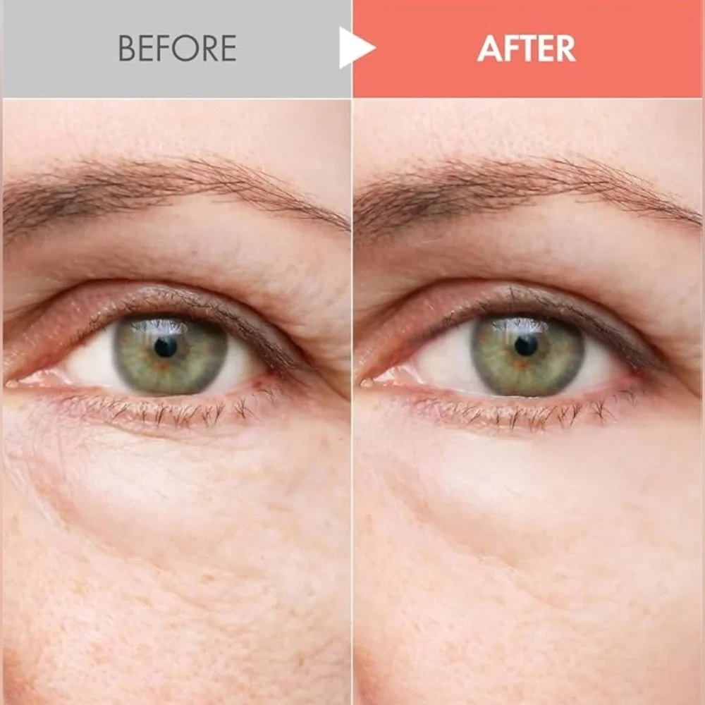 It’s Skin Collagen Nutrition Serum+ 40 mL/1.35 oz – Marine Collagen, Firming NWB - Picture 4 of 12